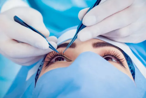 Læge udfører en øjenoperation grundet rynker på nethinden