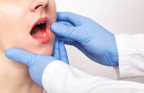 Symptomer og årsager til parodontitis