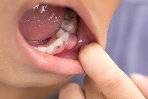 Symptomer på, at en tandinfektion har spredt sig til kroppen