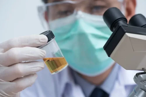 Laborant står med en urinprøve