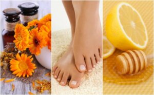 5 naturlige midler til behandling af nedgroede negle