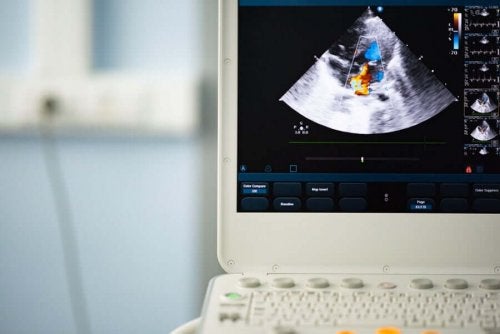 Bicuspid aortaklap: Diagnostik og behandling