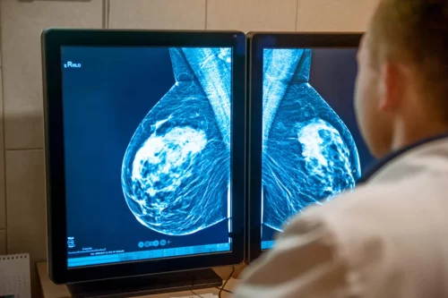Resultat af mamografi