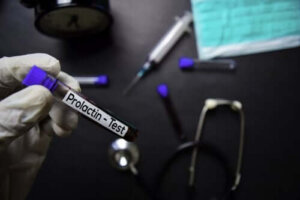 Normale prolaktinniveauer og hvorfor de kan ændre sig