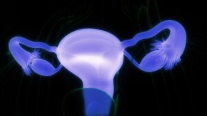 Dermoidcyster på æggestokkene: Symptomer og hvornår man skal gå til lægen