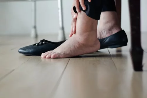 Hævede fødder