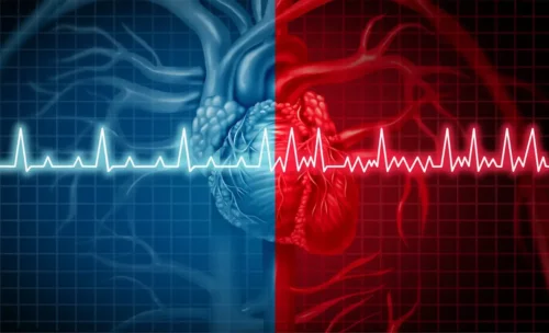 Illustration af hjertearytmi