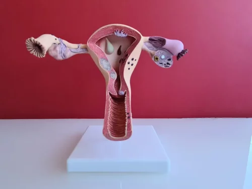 Illustration af livmoderen viser ooporektomi og kirurgisk overgangsalder