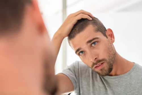 Mand med hårtab ønsker biostimulering af hår
