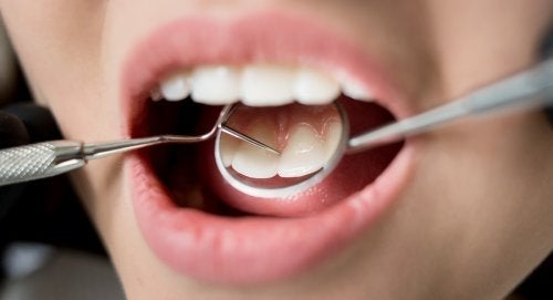 7 konsekvenser af dårlig mundhygiejne for dit helbred