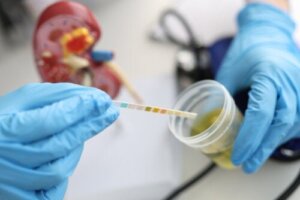 Urobilin i urinen: Årsager og normale værdier