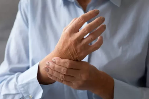 Person med håndledssmerter repræsenterer patienter med psoriasisgigt