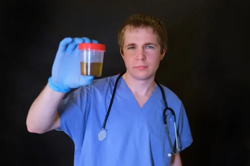 Læge står med urinprøve, der viser fedt i urinen