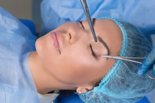 Kvinde gøres klar til at gennemgå øjenoperation grundet øjenlågets stilling