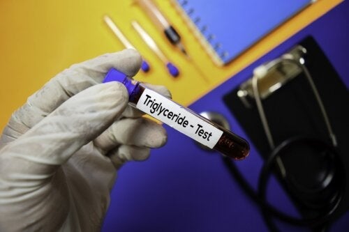 Triglyceridniveau: Hvad skal du vide?