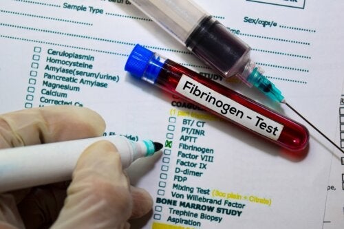 Fibrinogen i blodprøver: Funktioner og resultater