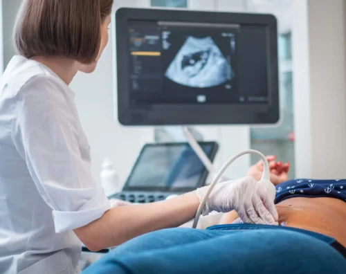 Gravid kvinde scannes