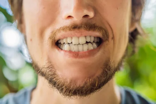 En mand viser sine tænder frem