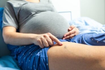 Årebetændelse i graviditeten: Symptomer og behandling