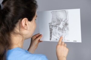 Hvad er mandibular retrognathia, og hvordan behandles det?