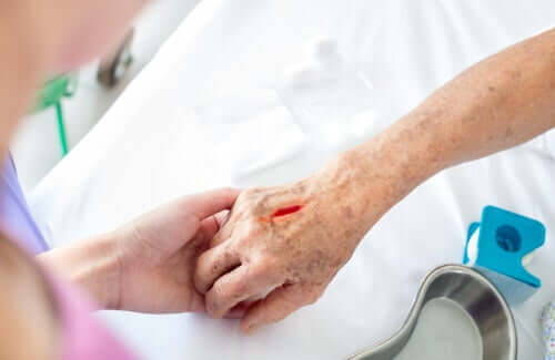 Nekrotiserende fasciitis: Alt hvad du behøver at vide