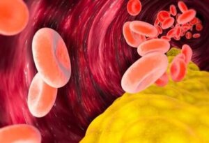 Er VLDL-kolesterol skadeligt?