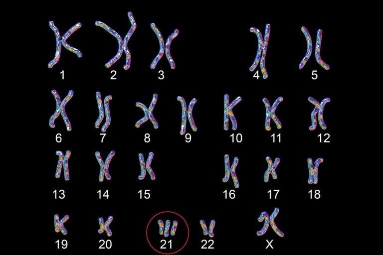 Kromosomer ændrer sig  ved Downs syndrom