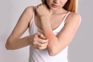 Neurodermatitis: Årsager, symptomer og behandling