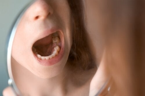 Papillomer i munden: Tegn og forebyggelse