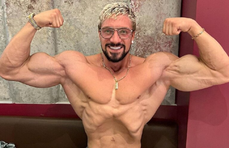 Hjerneaneurisme: Influencer og bodybuilder Jo Lindners dødsårsag